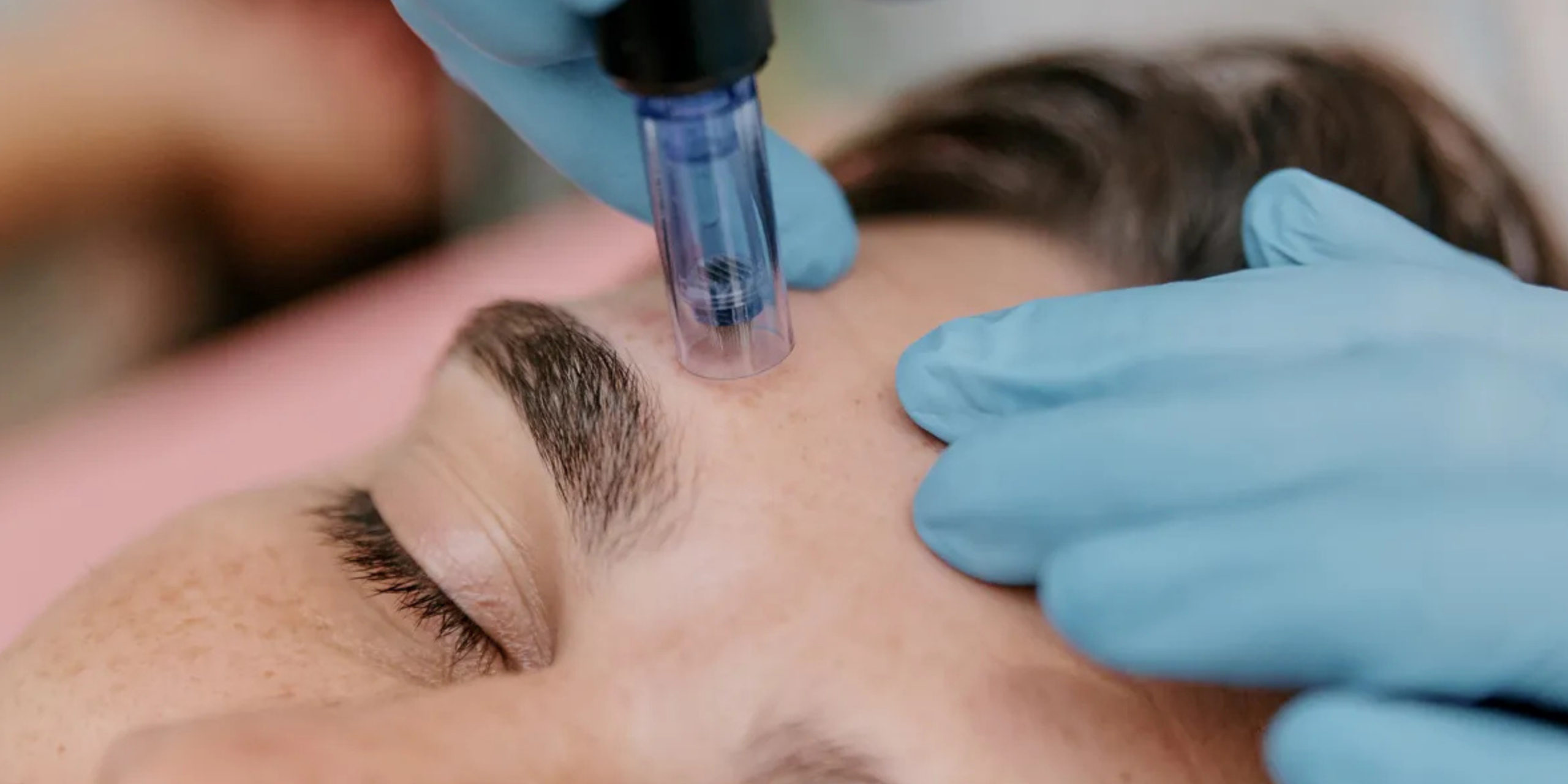 microneedling ghk cu study Copper Peptides & GHK-Cu: A Guide for Aestheticians Anti Allergy Injection